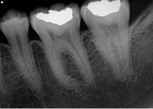 Image of an x-ray
